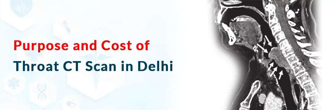 Purpose and Cost of Throat CT Scan in Delhi NCR